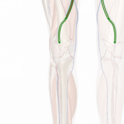 Bypass vascular peripheral vein saphenous femoropopliteal graft popliteal femoral artery incision procedure fem diseased